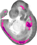 mouse atlas EMAGE spatial in situ gene expression database None