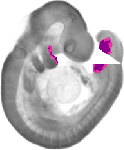mouse atlas EMAGE spatial in situ gene expression database None