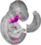 mouse atlas EMAGE spatial in situ gene expression database None