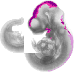 mouse atlas EMAGE spatial in situ gene expression database None