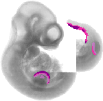 mouse atlas EMAGE spatial in situ gene expression database None