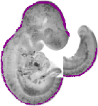 mouse atlas EMAGE spatial in situ gene expression database None
