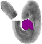 mouse atlas EMAGE spatial in situ gene expression database None