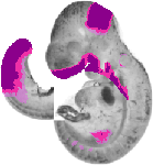 mouse atlas EMAGE spatial in situ gene expression database None