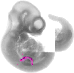 mouse atlas EMAGE spatial in situ gene expression database None