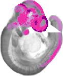 mouse atlas EMAGE spatial in situ gene expression database None