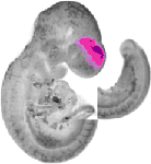 mouse atlas EMAGE spatial in situ gene expression database None