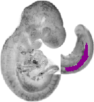 mouse atlas EMAGE spatial in situ gene expression database None