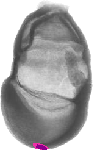 mouse atlas EMAGE spatial in situ gene expression database None