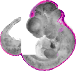 mouse atlas EMAGE spatial in situ gene expression database None