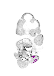 mouse atlas EMAGE spatial in situ gene expression database None