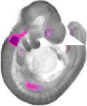 mouse atlas EMAGE spatial in situ gene expression database None