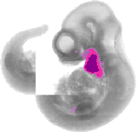 mouse atlas EMAGE spatial in situ gene expression database None