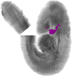 mouse atlas EMAGE spatial in situ gene expression database None