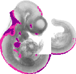 mouse atlas EMAGE spatial in situ gene expression database None