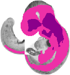 mouse atlas EMAGE spatial in situ gene expression database None