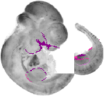 mouse atlas EMAGE spatial in situ gene expression database None