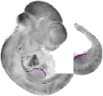 mouse atlas EMAGE spatial in situ gene expression database None