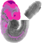 mouse atlas EMAGE spatial in situ gene expression database None