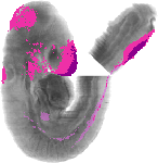 mouse atlas EMAGE spatial in situ gene expression database None