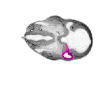 mouse atlas EMAGE spatial in situ gene expression database None