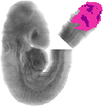 mouse atlas EMAGE spatial in situ gene expression database None