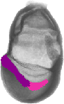 mouse atlas EMAGE spatial in situ gene expression database None