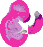 mouse atlas EMAGE spatial in situ gene expression database None