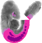 mouse atlas EMAGE spatial in situ gene expression database None