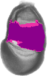 mouse atlas EMAGE spatial in situ gene expression database None
