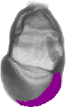 mouse atlas EMAGE spatial in situ gene expression database None