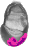 mouse atlas EMAGE spatial in situ gene expression database None