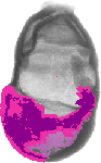 mouse atlas EMAGE spatial in situ gene expression database None