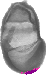mouse atlas EMAGE spatial in situ gene expression database None