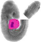 mouse atlas EMAGE spatial in situ gene expression database None