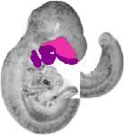 mouse atlas EMAGE spatial in situ gene expression database None