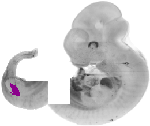 mouse atlas EMAGE spatial in situ gene expression database None