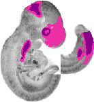 mouse atlas EMAGE spatial in situ gene expression database None