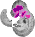 mouse atlas EMAGE spatial in situ gene expression database None