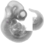 mouse atlas EMAGE spatial in situ gene expression database None