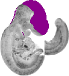mouse atlas EMAGE spatial in situ gene expression database None
