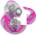 mouse atlas EMAGE spatial in situ gene expression database None