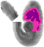 mouse atlas EMAGE spatial in situ gene expression database None
