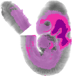 mouse atlas EMAGE spatial in situ gene expression database None
