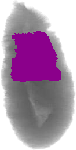 mouse atlas EMAGE spatial in situ gene expression database None