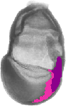 mouse atlas EMAGE spatial in situ gene expression database None