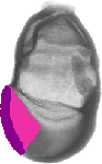 mouse atlas EMAGE spatial in situ gene expression database None