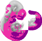 mouse atlas EMAGE spatial in situ gene expression database None