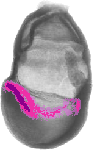 mouse atlas EMAGE spatial in situ gene expression database None