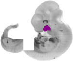mouse atlas EMAGE spatial in situ gene expression database None